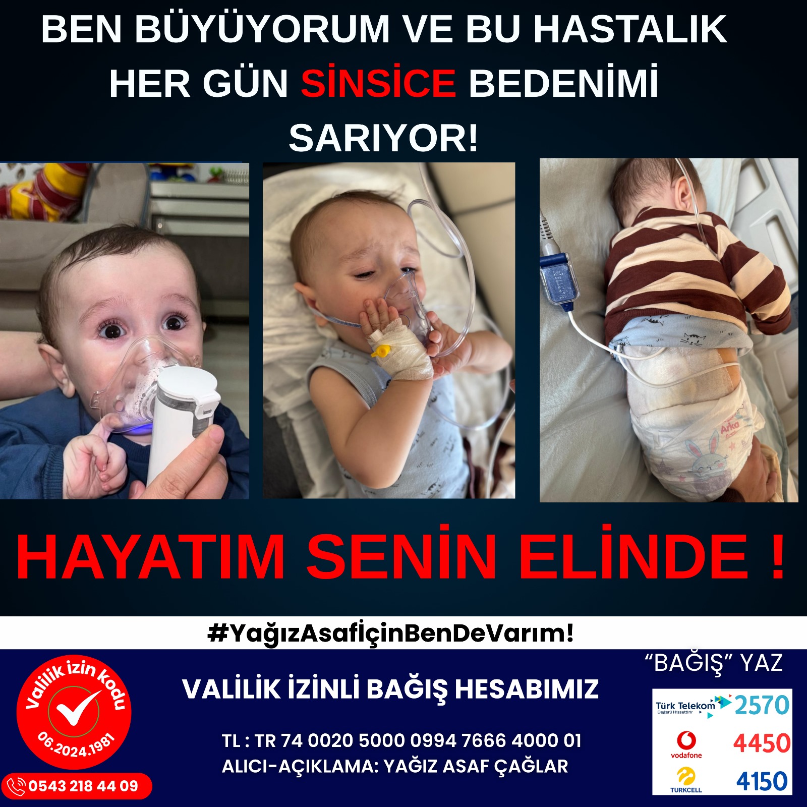 Minik Yağız Asaf’ın Yaşam Mücadelesine Destek Bekleniyor